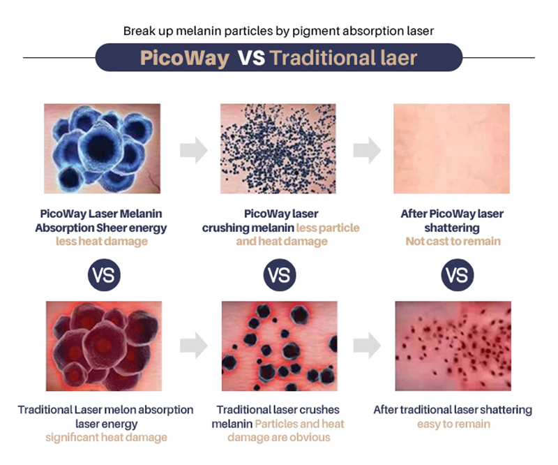 Picosecond: A New Chapter in Laser Aesthetics